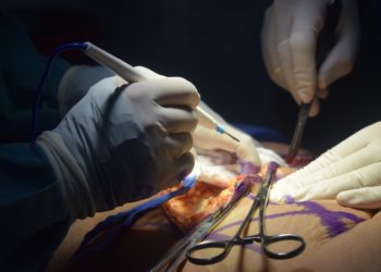 Ein Schönheits-Chirurg steht unter Verdacht des Ärzte-Pfuschs. (Foto: Catalina Rojas, Pixabay)